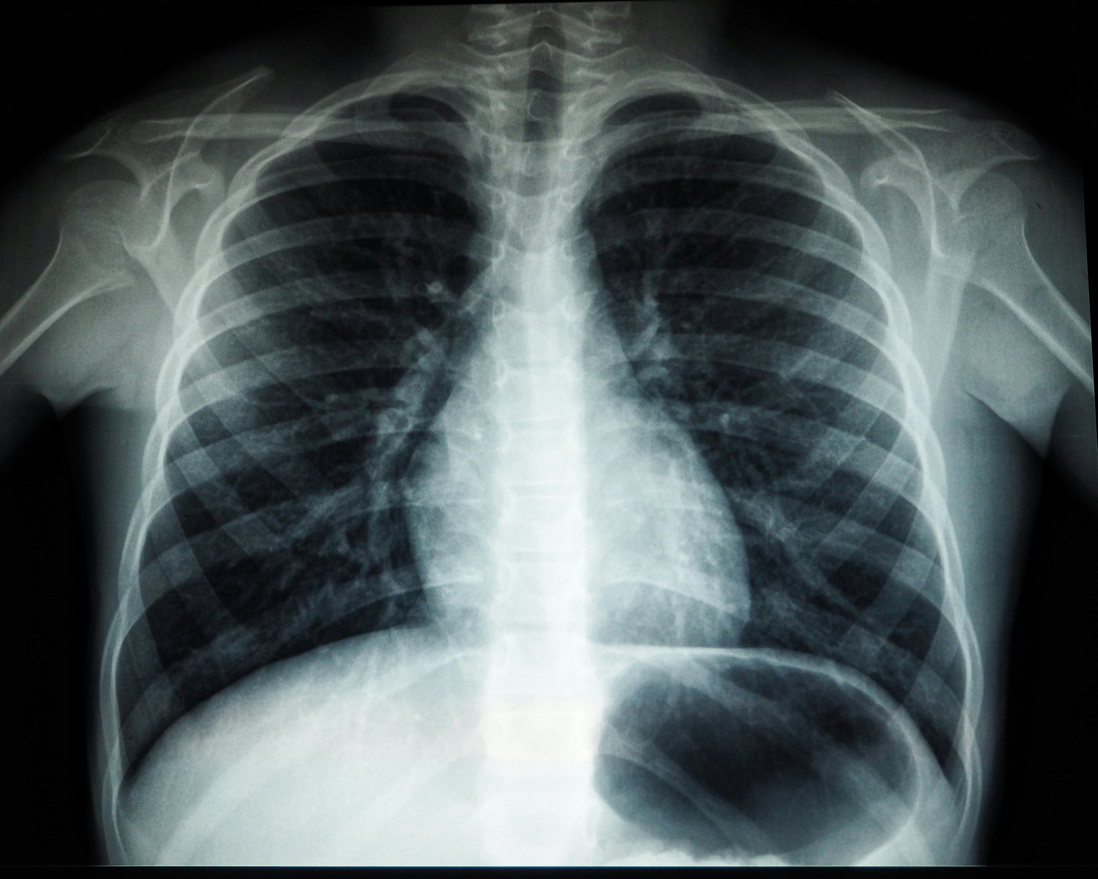 Diagnostics Slide 5